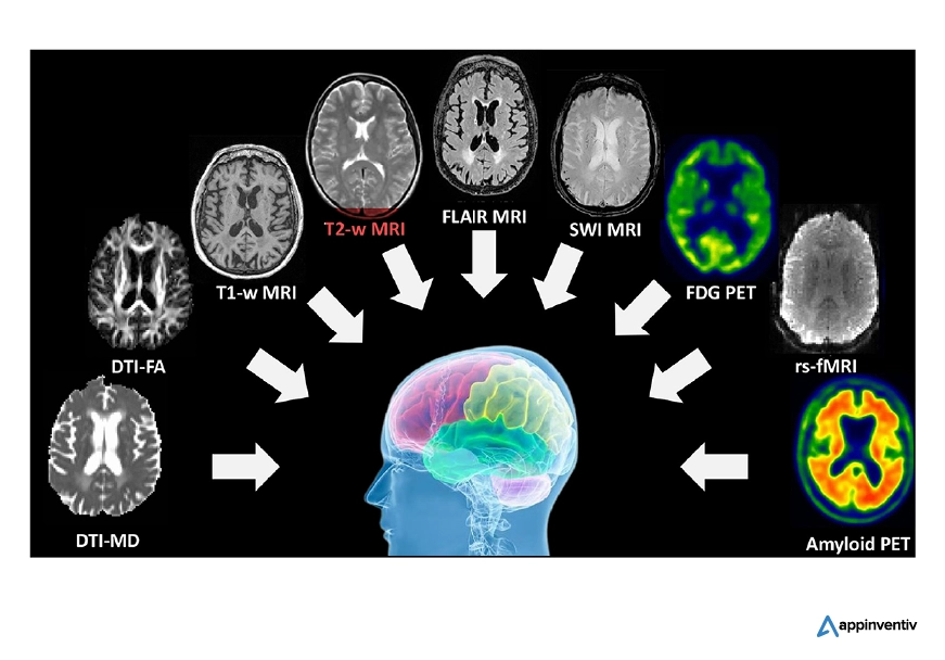 AI in neurological imaging