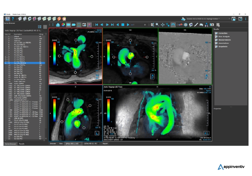 AI in Cardiac Imaging Enhancement