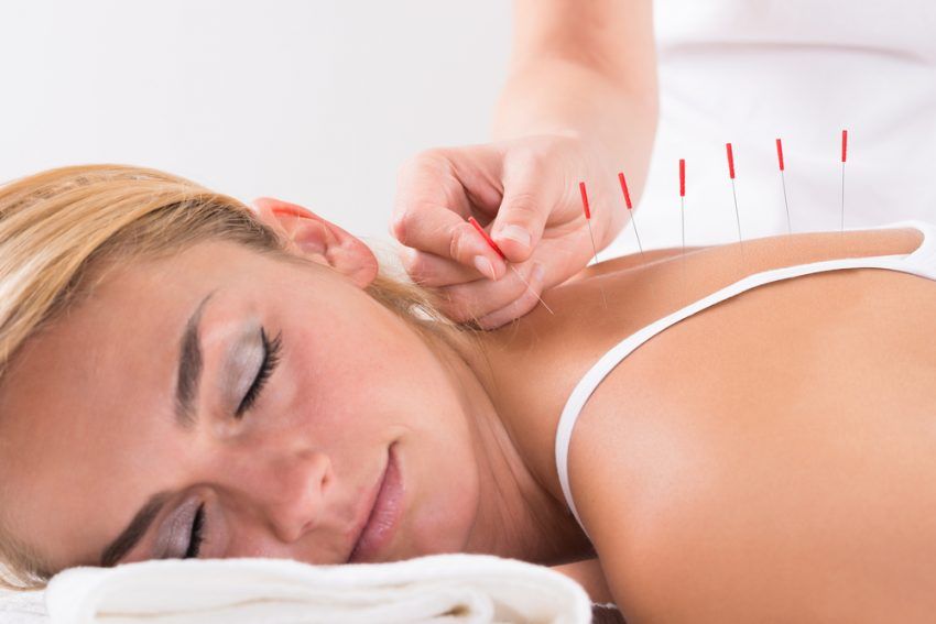 50 idées d'entreprises de soins de santé - Acupuncteur